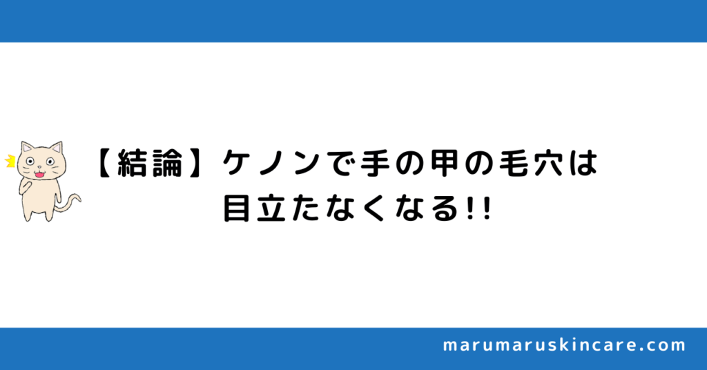 ケノンで手の甲の毛穴は消えるか解説